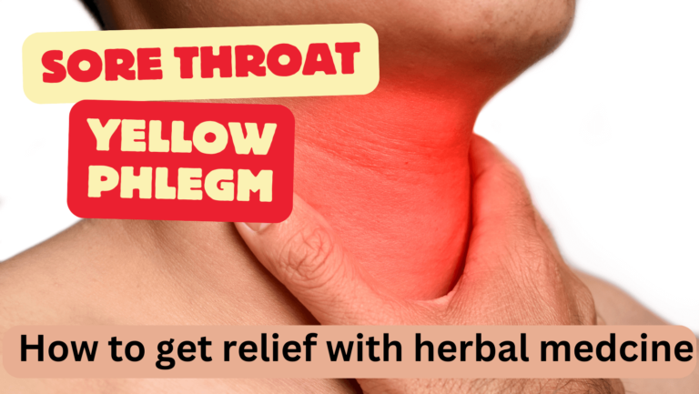 Sore throat yellow phlegm